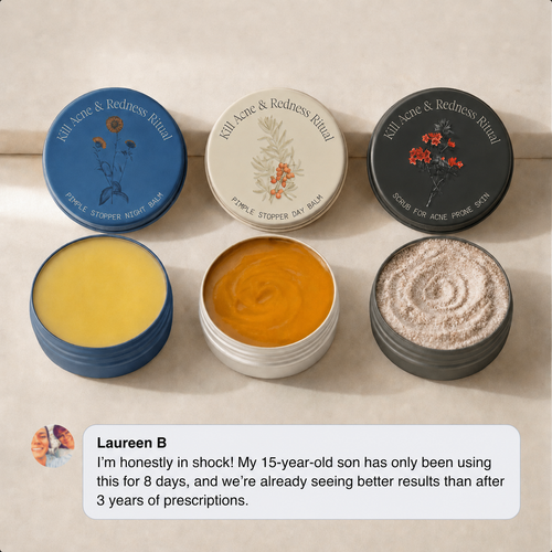 Kill Acne & Redness Ritual
