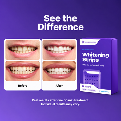Purple Teeth Whitening Strips