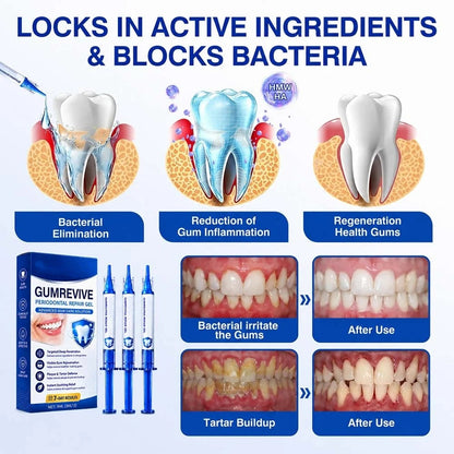 GumRevive Periodontal Repair Gel