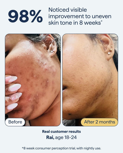 Dark Spot Correcting Advanced Serum, Buy 1 Get 1 Free!