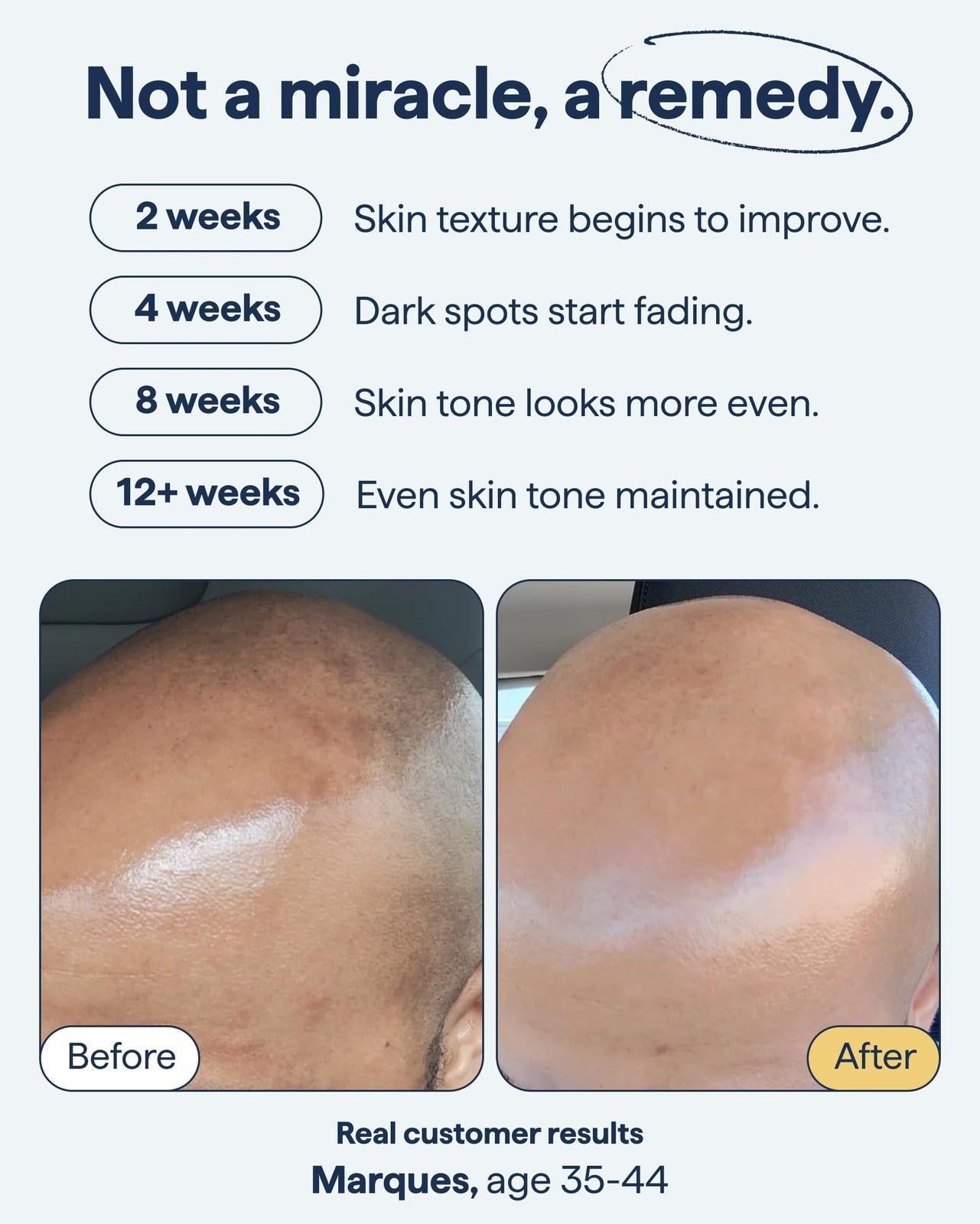 Dark Spot Correcting Advanced Serum, Buy 1 Get 1 Free!