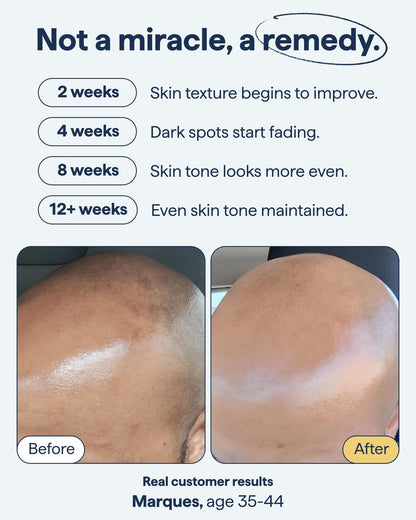 Dark Spot Correcting Advanced Serum, Buy 1 Get 1 Free!
