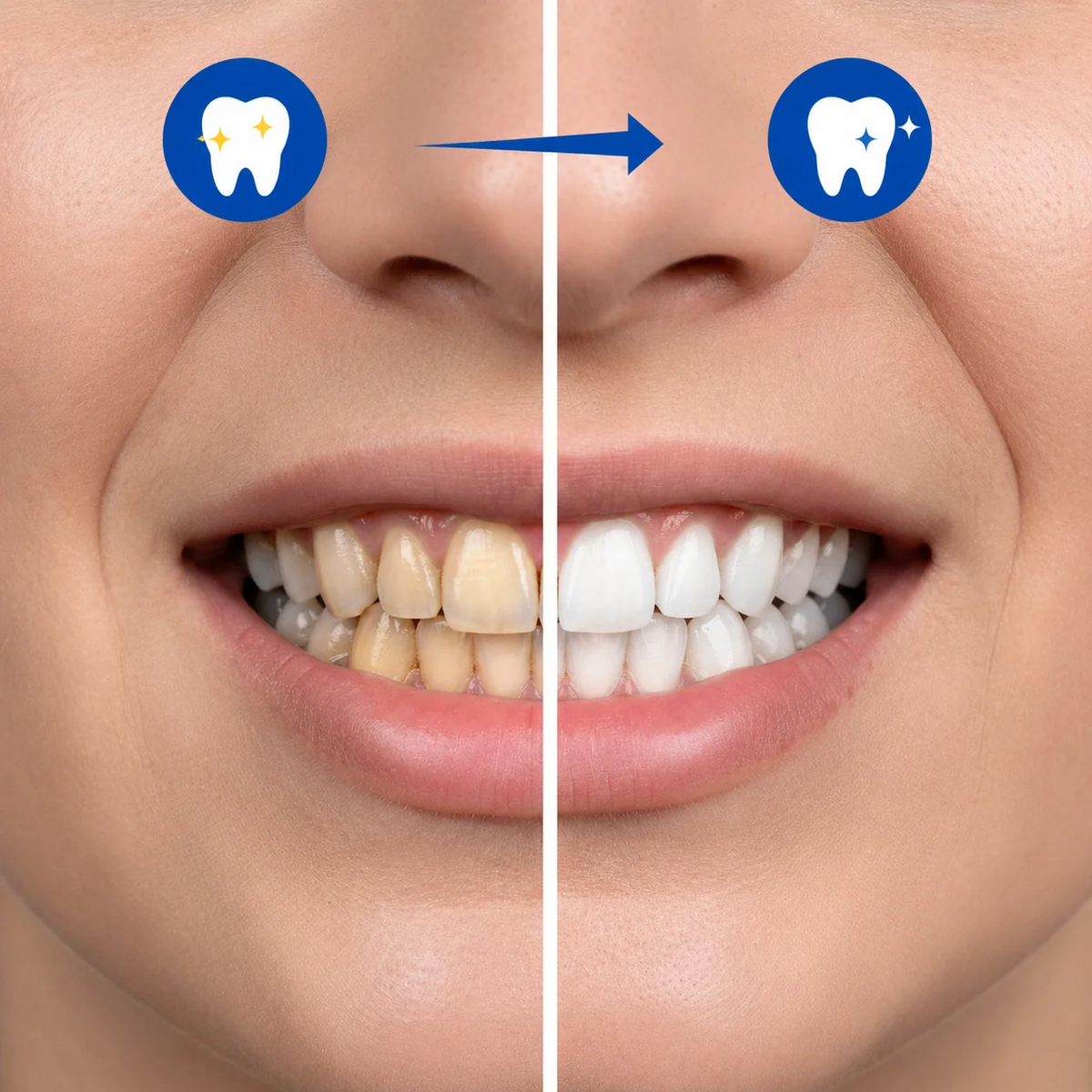 Purple Teeth Whitening Strips