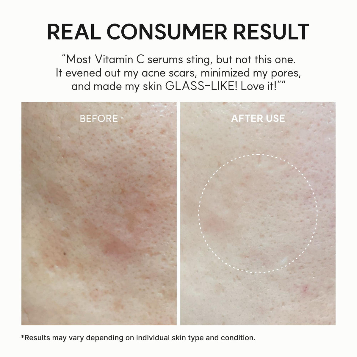 Vitamin C Booster Shot Serum with Glutathione